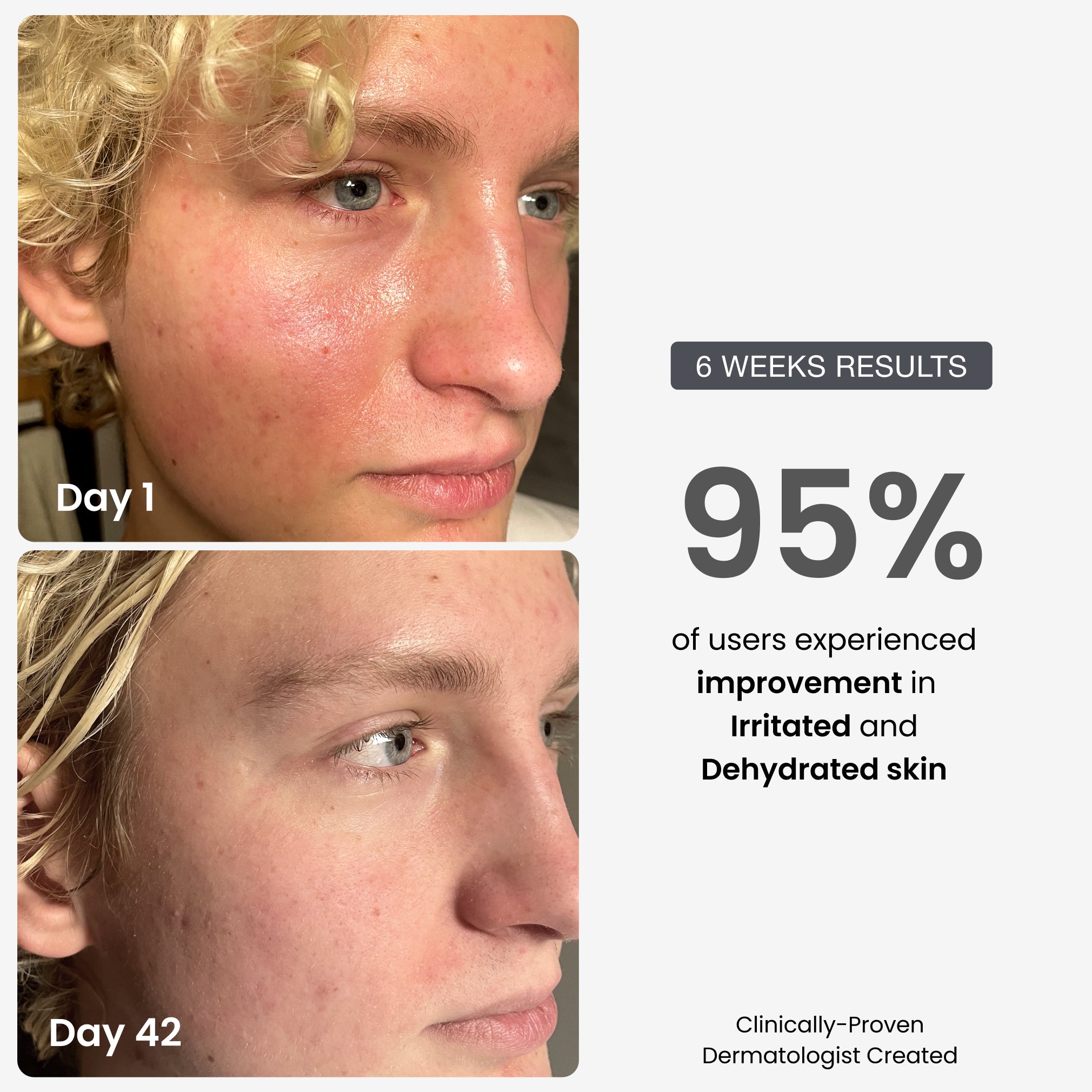 The Skin Renewal Set