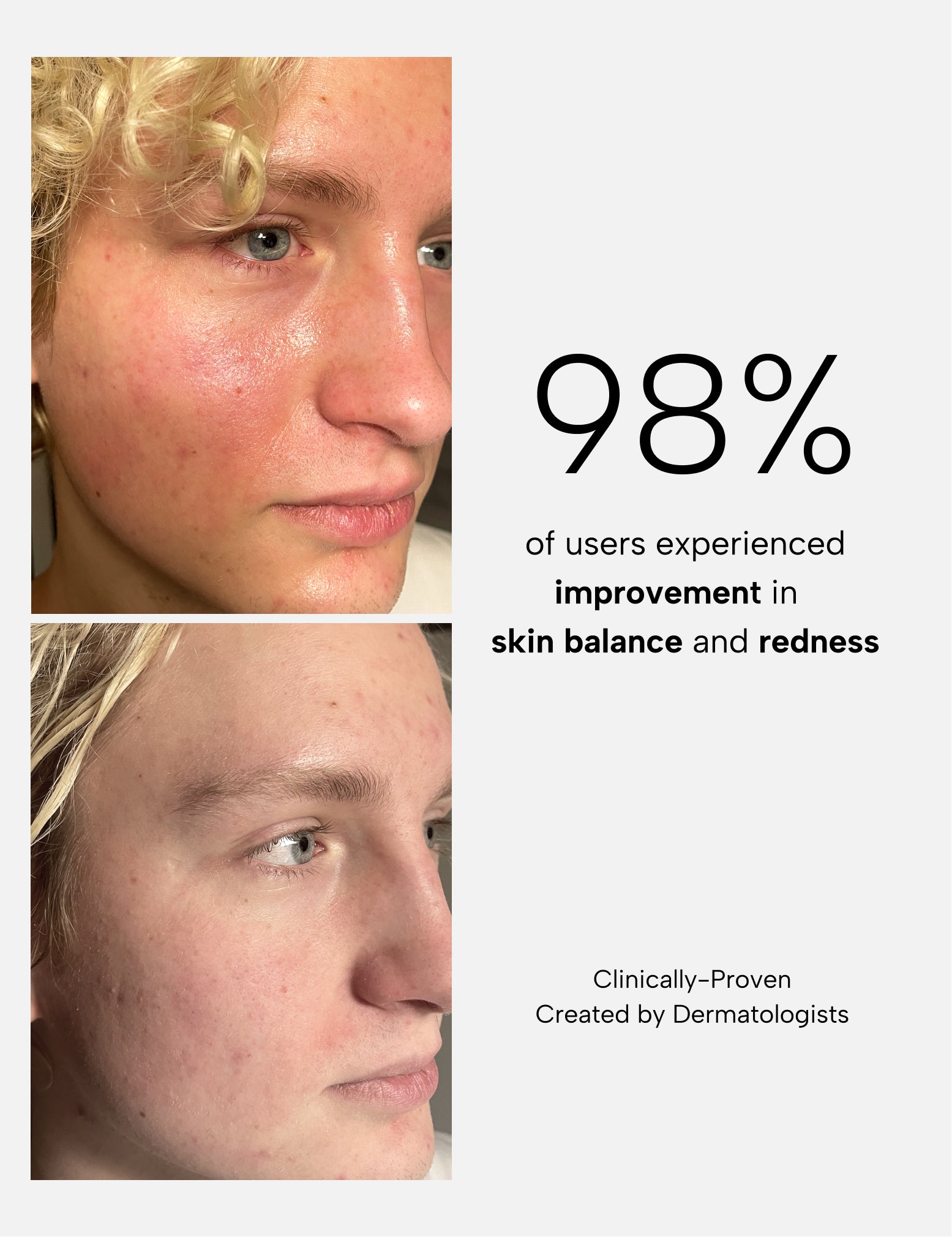 ADVANCE LIFT + BRIGHTEN COMPLETE ANTI-AGING ROUTINE