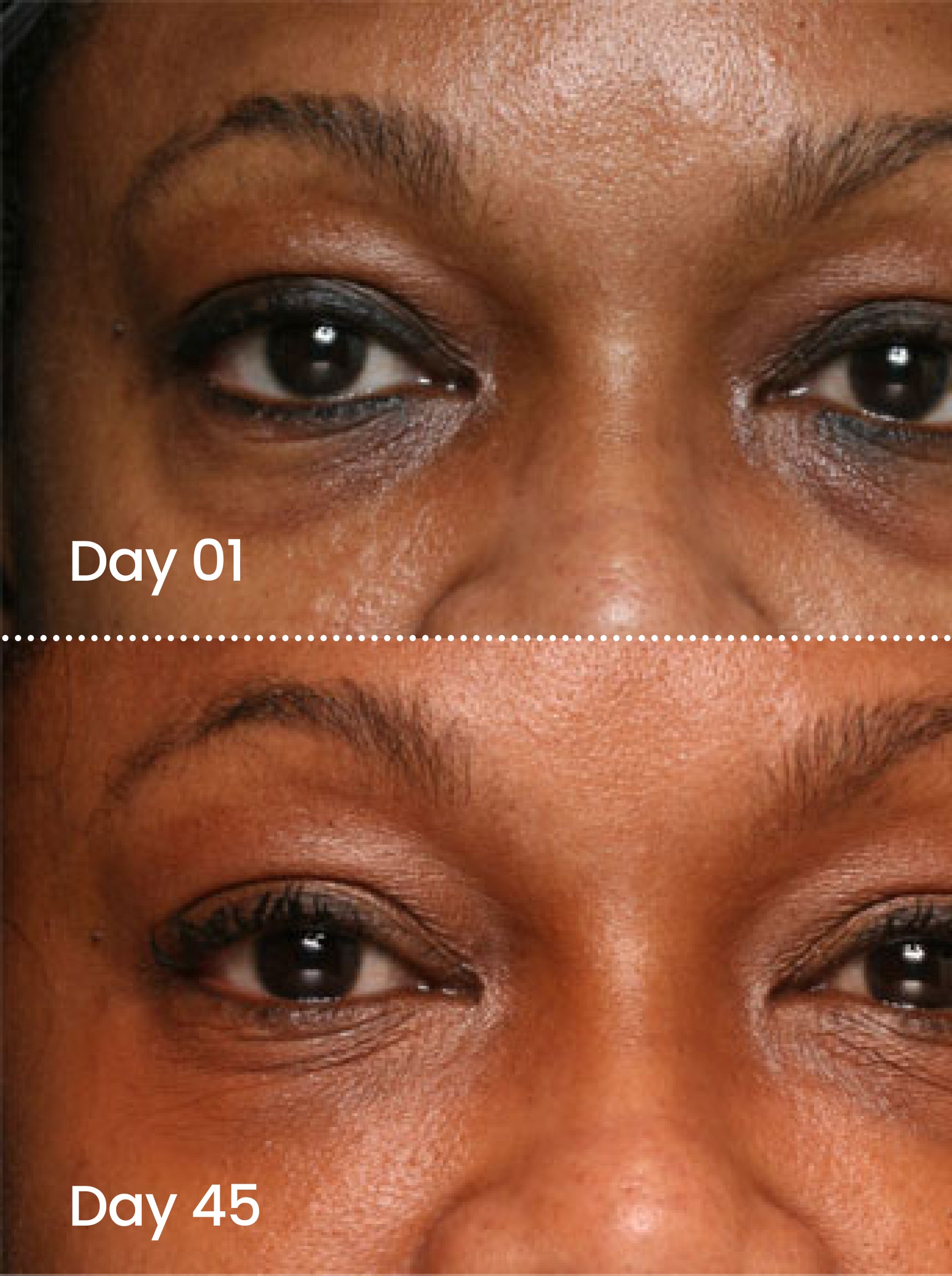 EYE SMOOTH™ Renewal eye serum