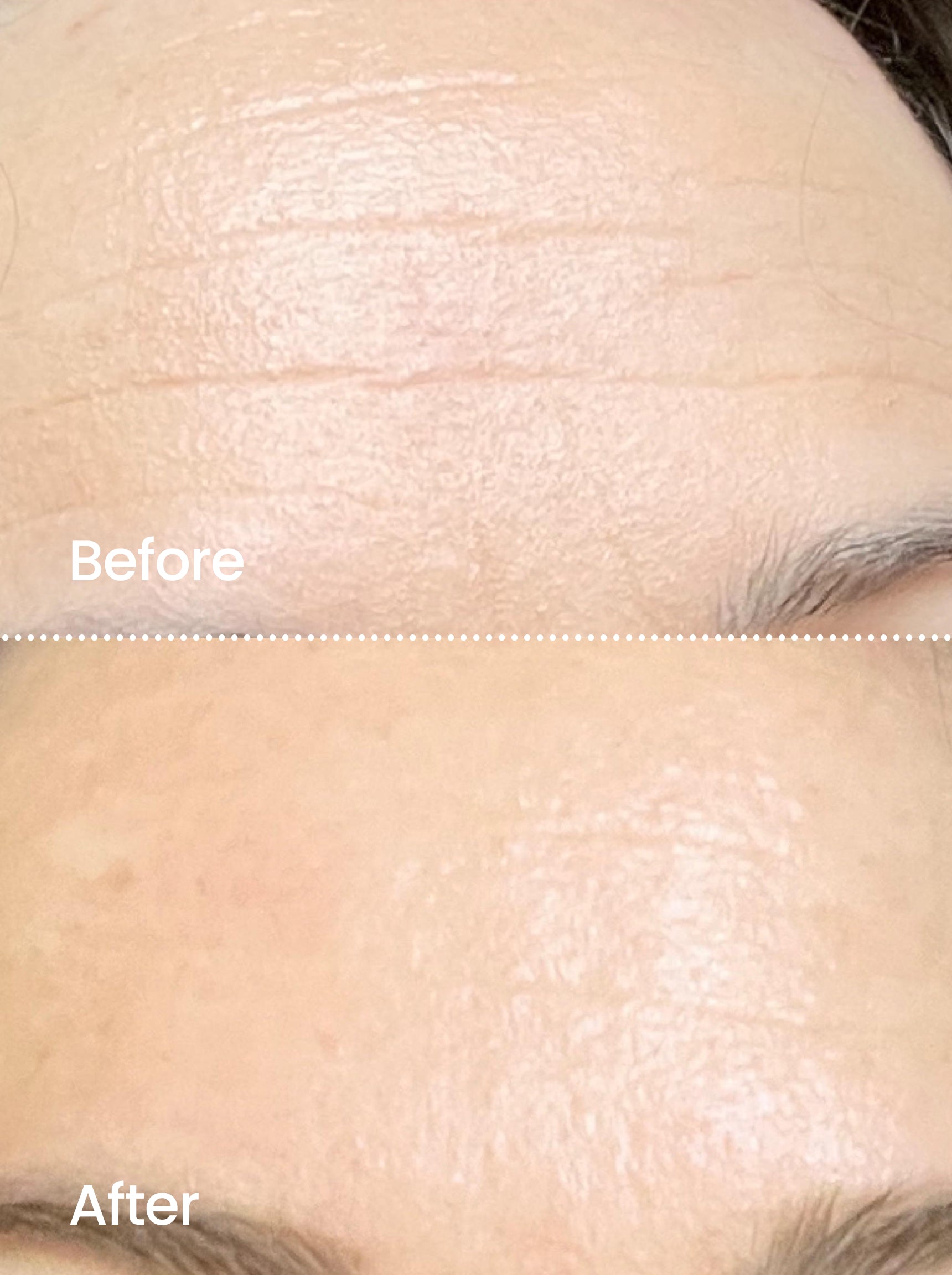 AGE RESET™ Night Serum