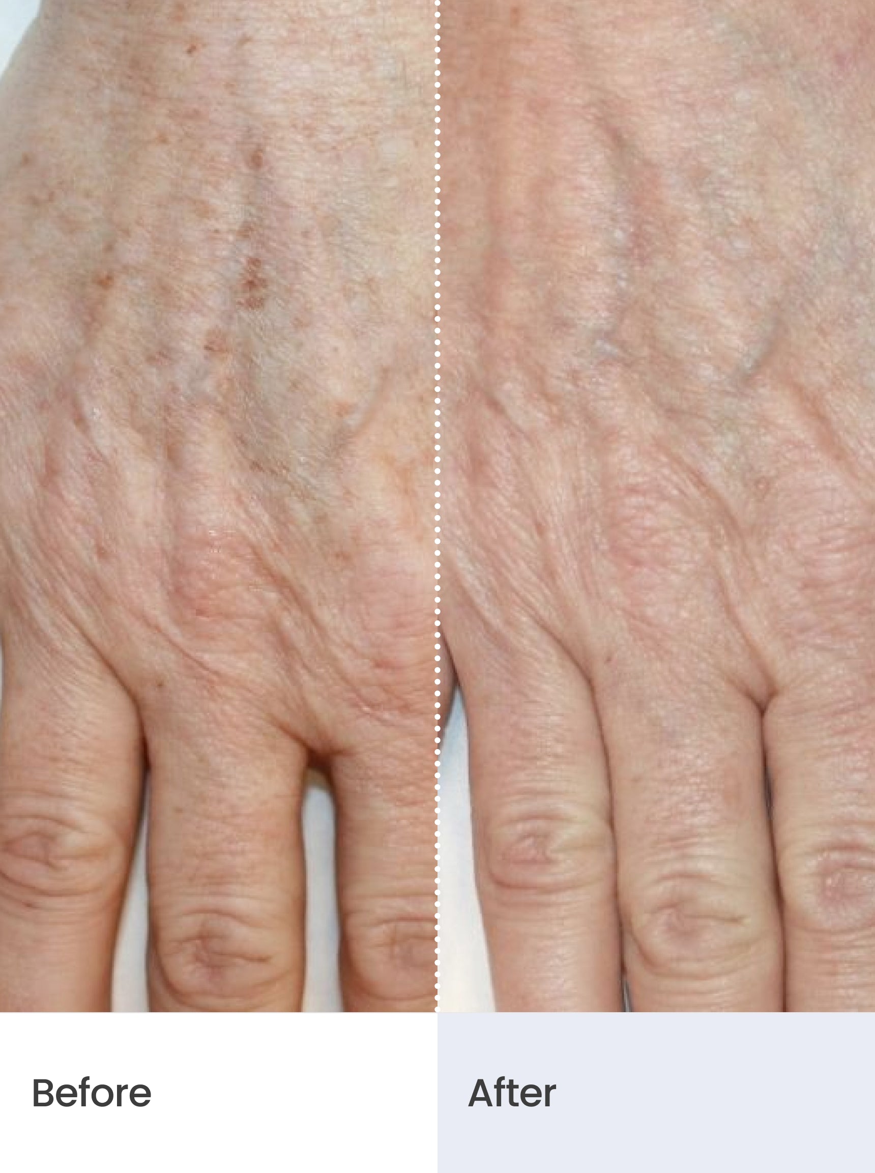 TONE CORRECT™ Dark Spot Serum