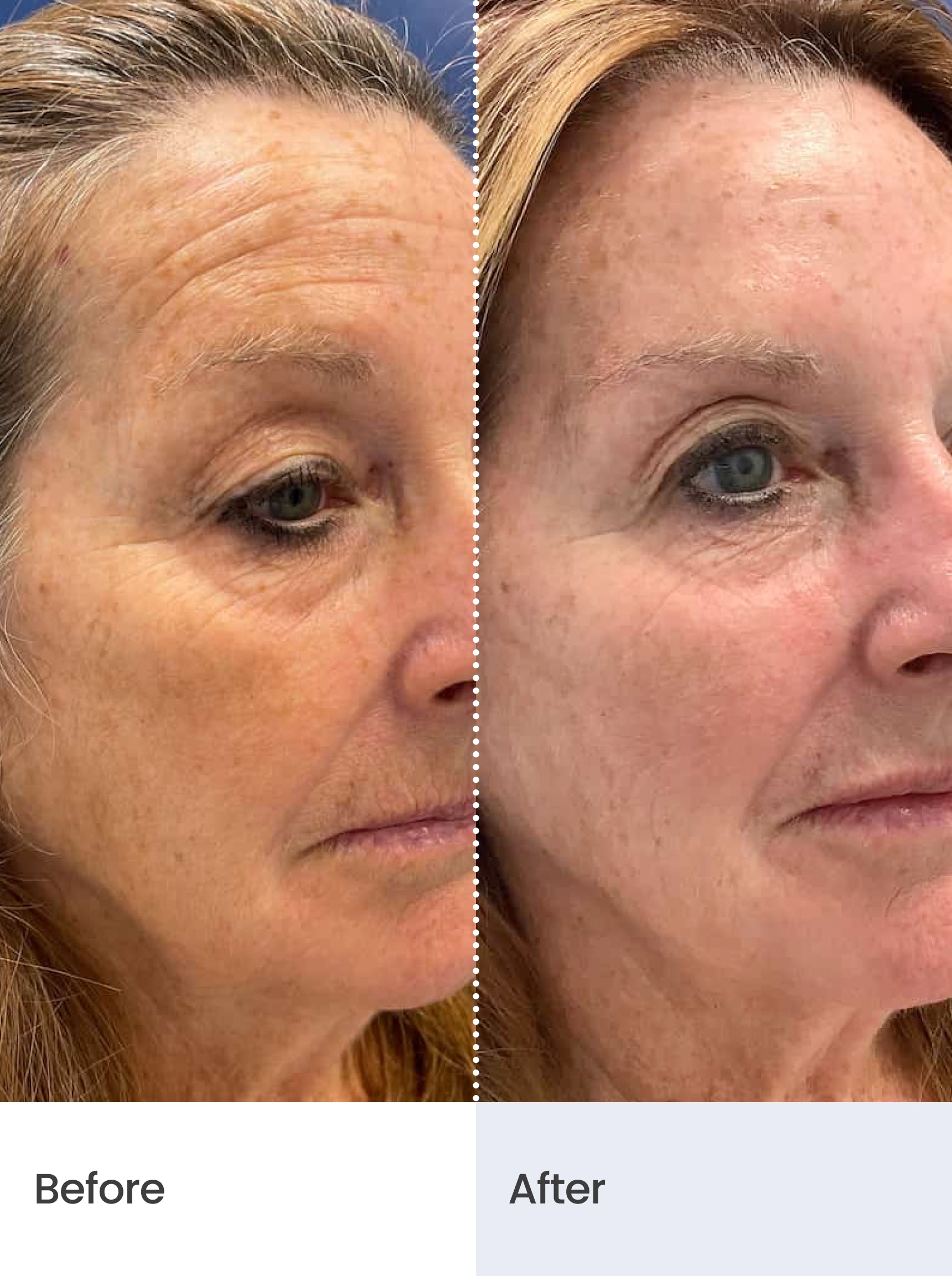 OVERNIGHT REPAIR™ Collagen Night Cream