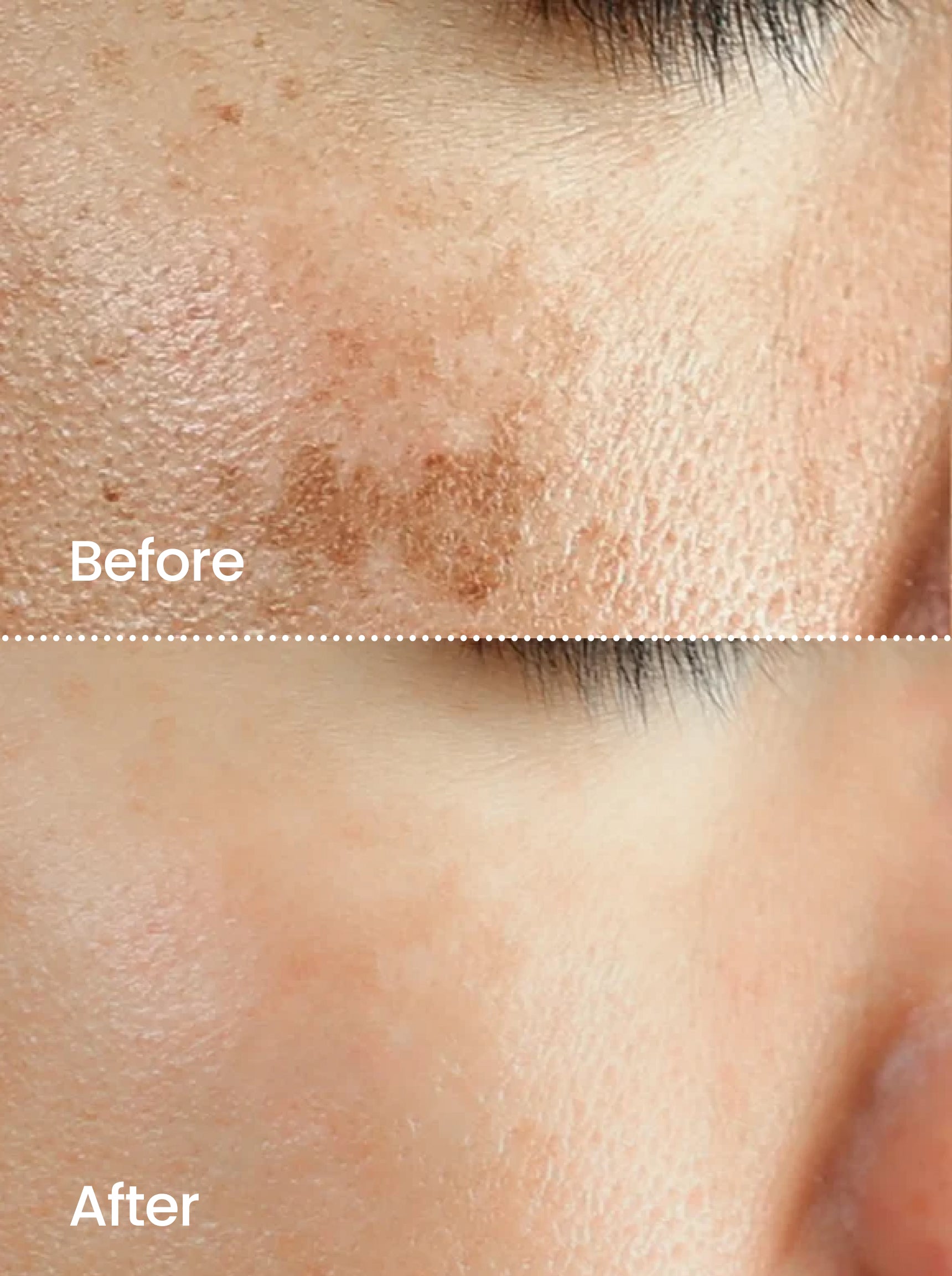 TONE CORRECT™ Dark Spot Serum