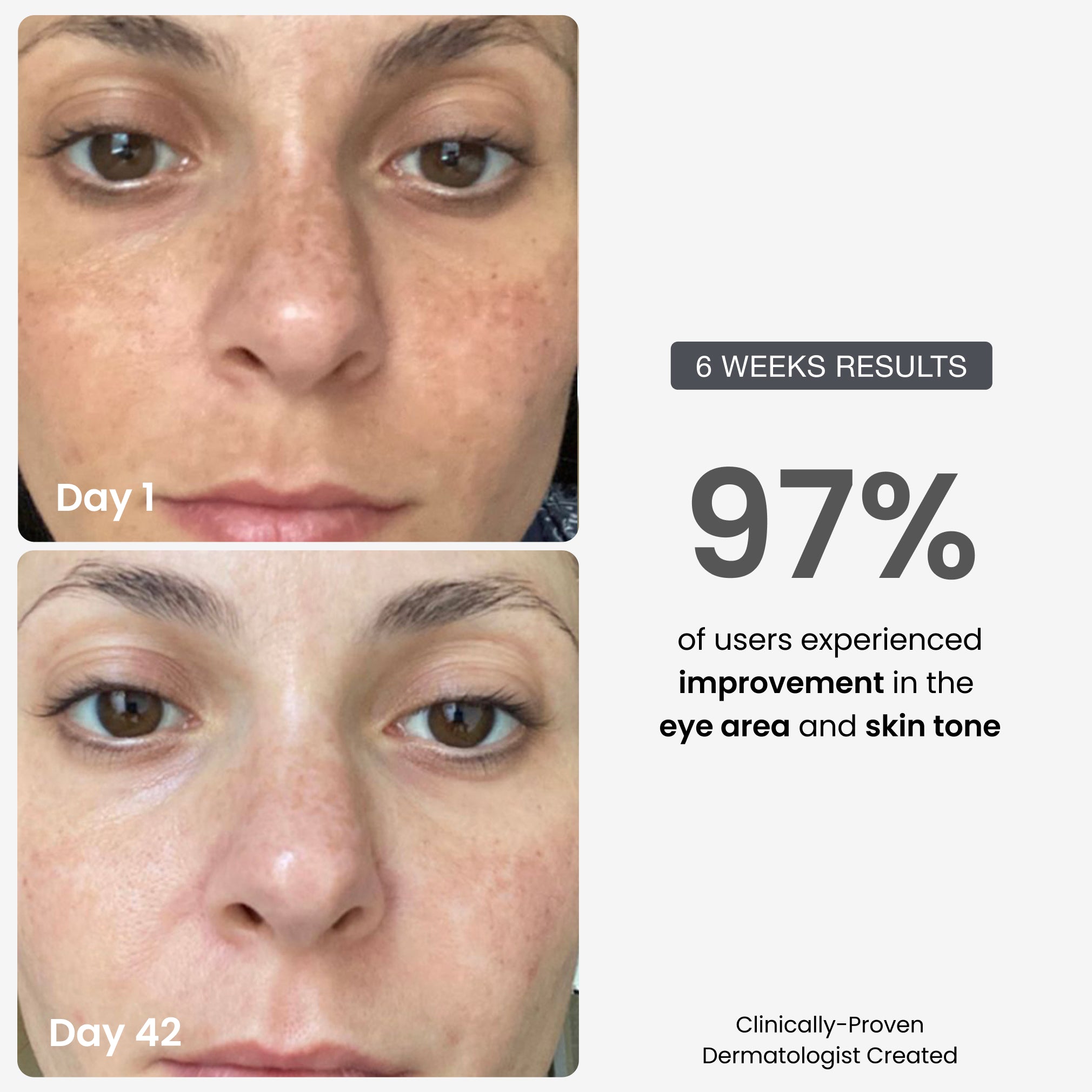 Vitamin C serum + Day Cream SPF30