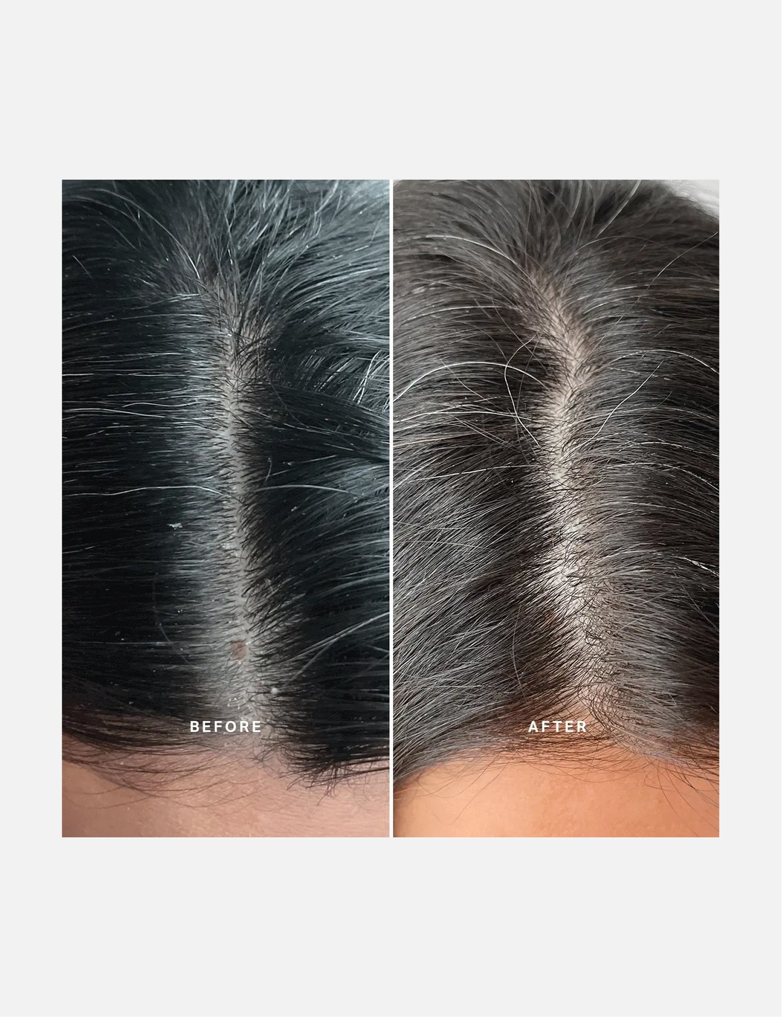 DEEP DETOX & SCALP ACTIVATION KERATIN SCRUB