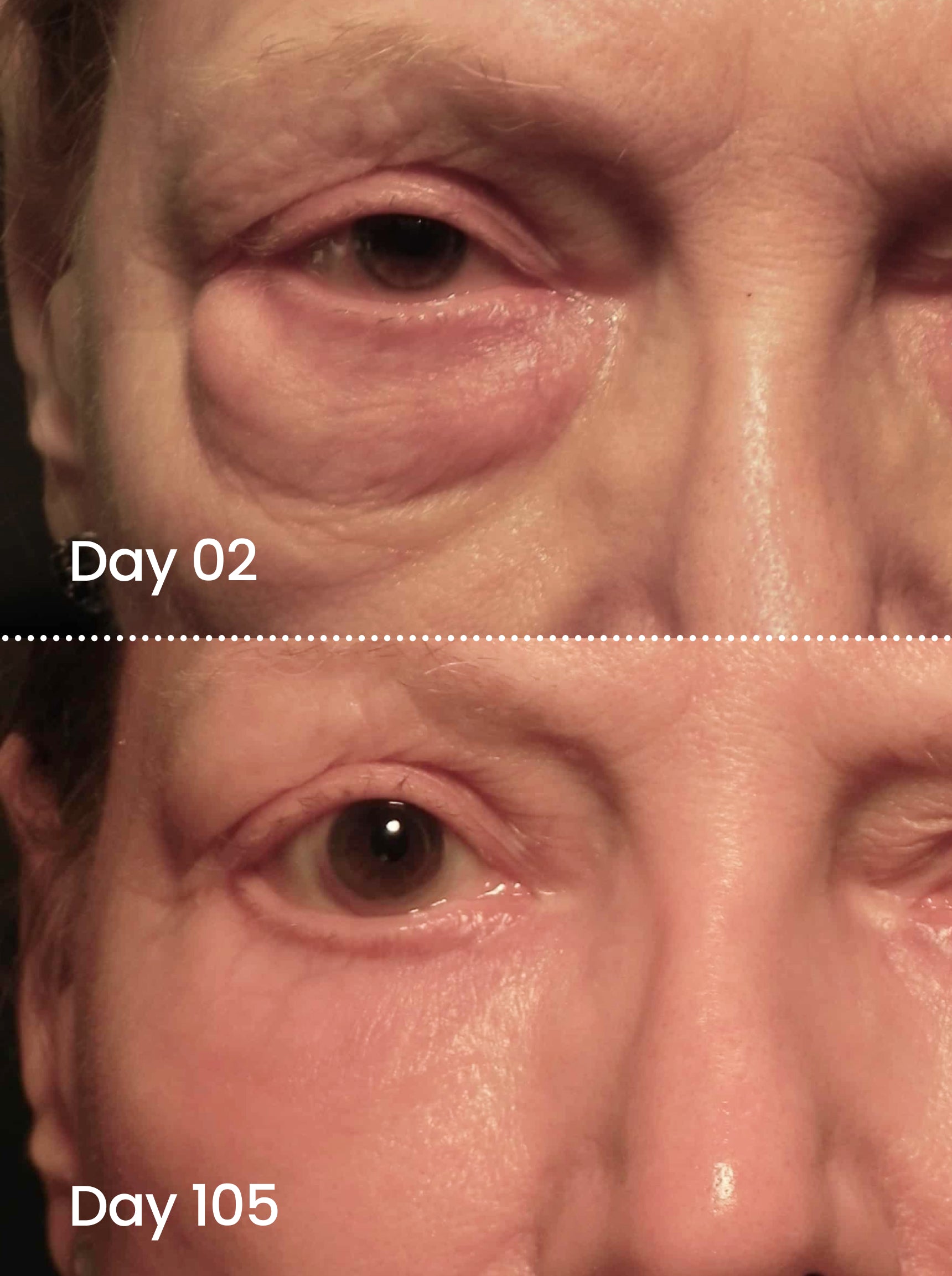 EYE SMOOTH™ Renewal eye serum