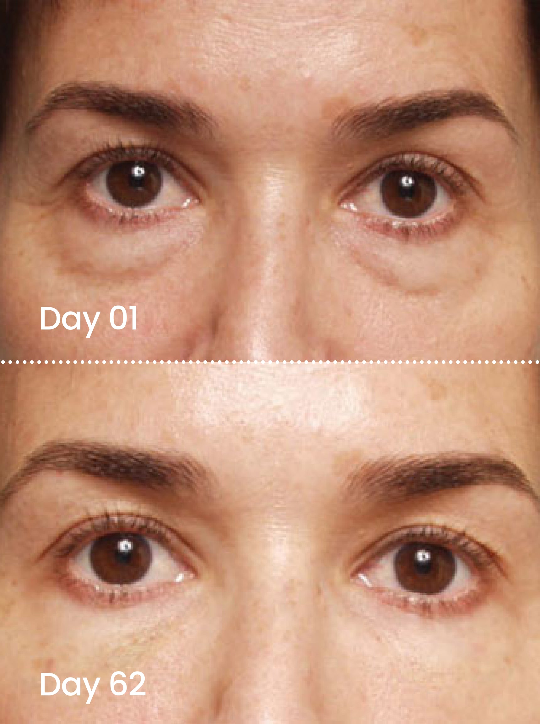 EYE SMOOTH™ Renewal eye serum