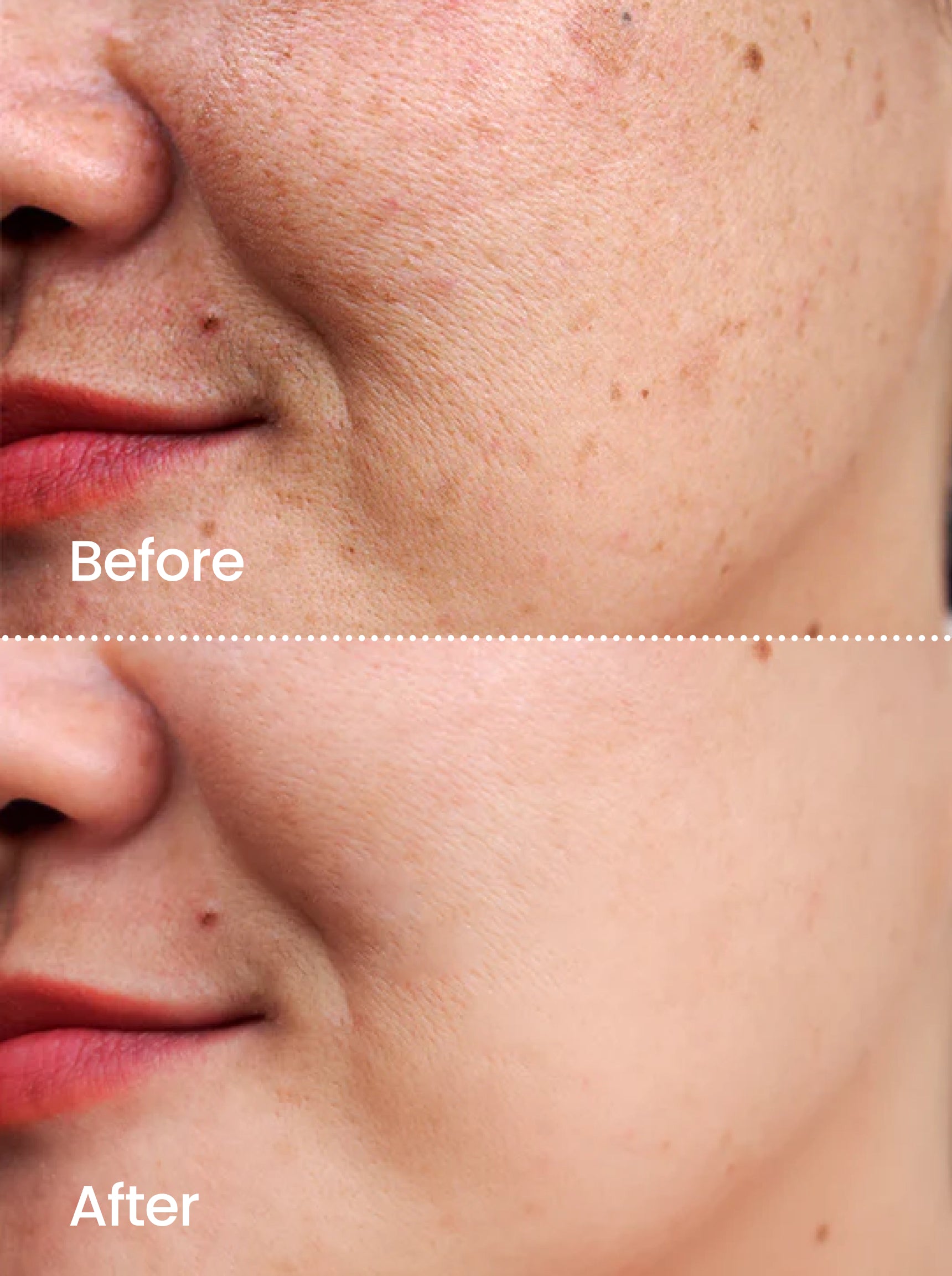 TONE CORRECT™ Dark Spot Serum