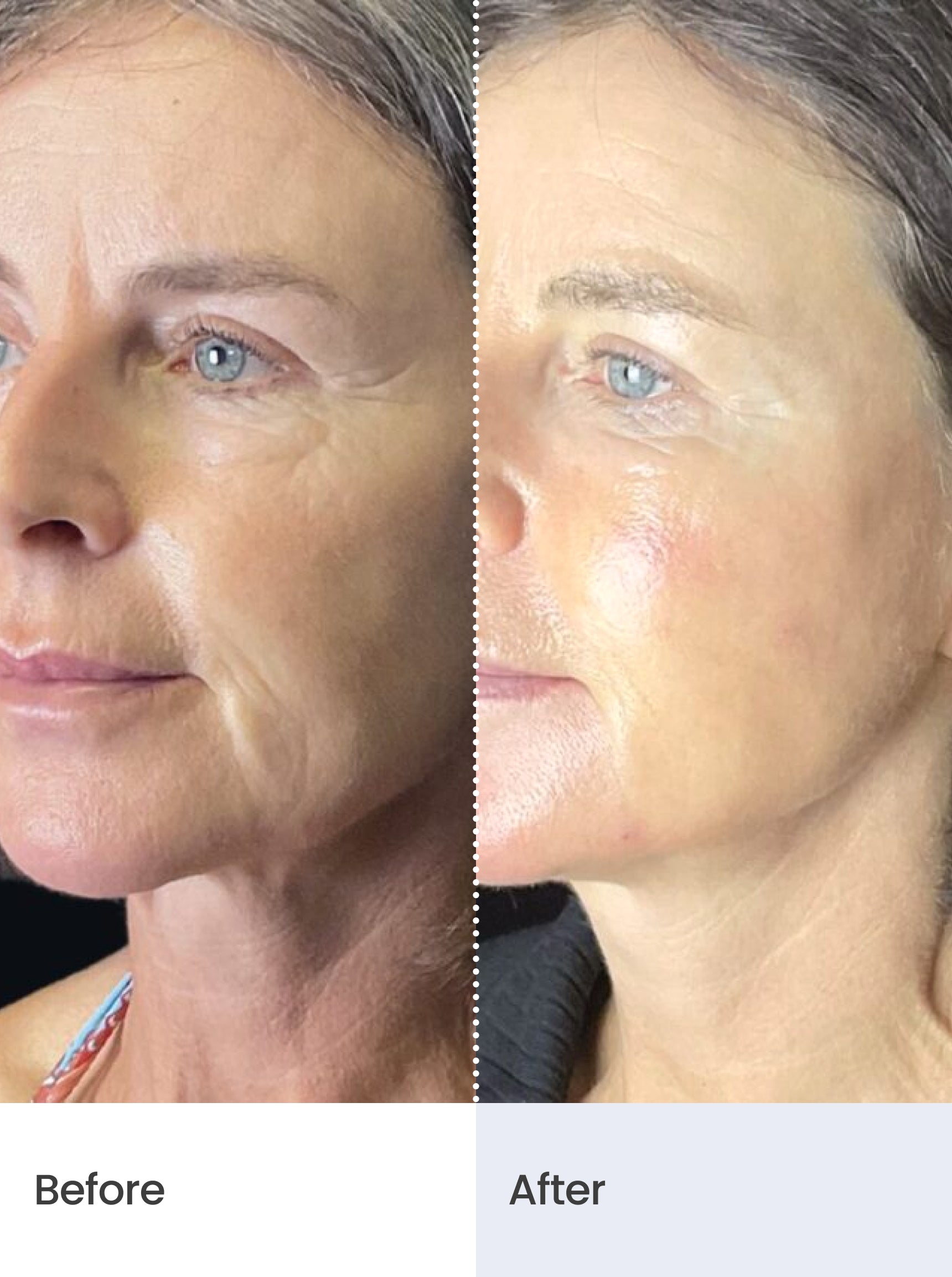 OVERNIGHT REPAIR™ Collagen Night Cream