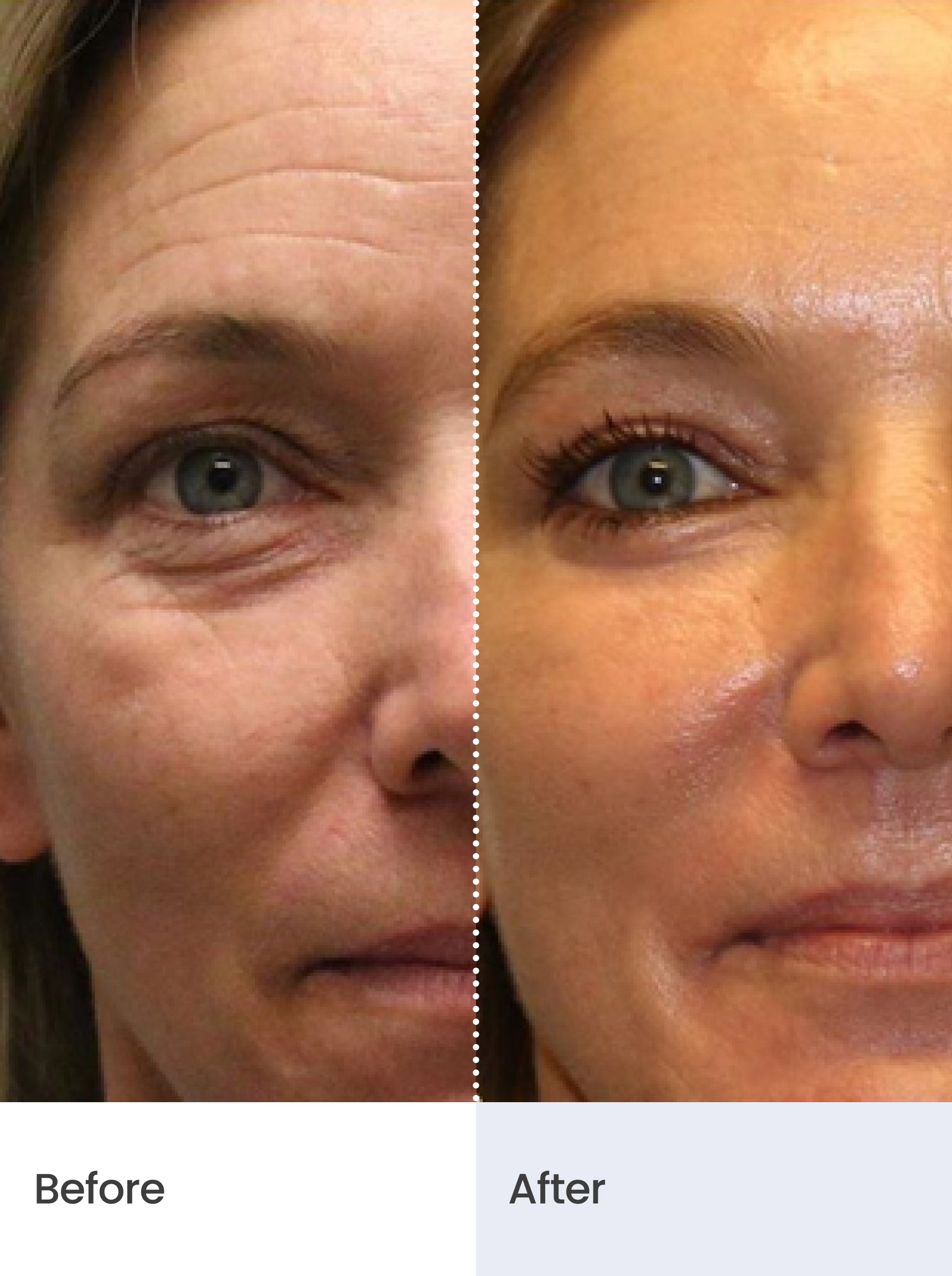 HYDRA-LIFT™ Anti-aging Day Cream