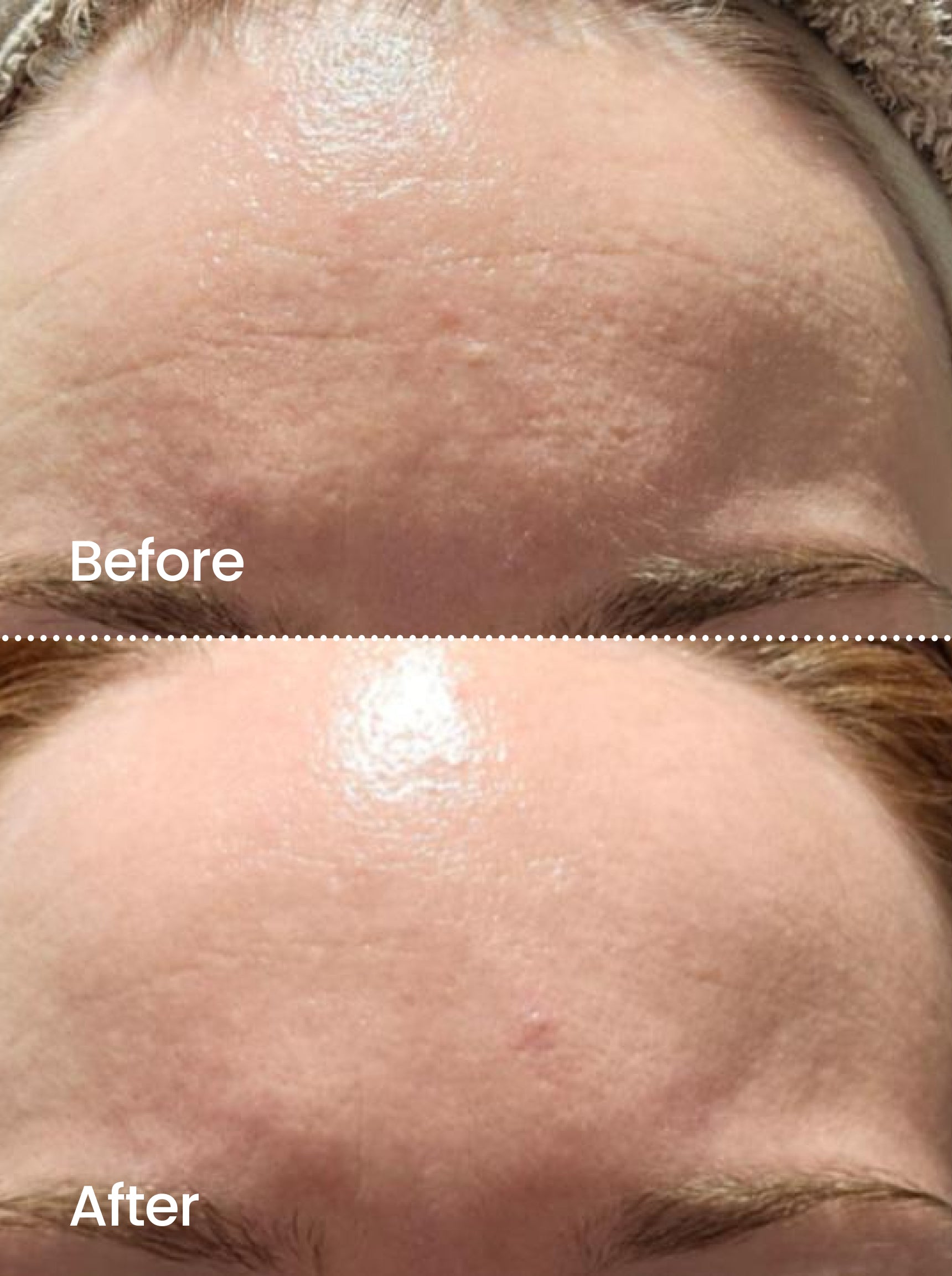 AGE RESET™ Night Serum