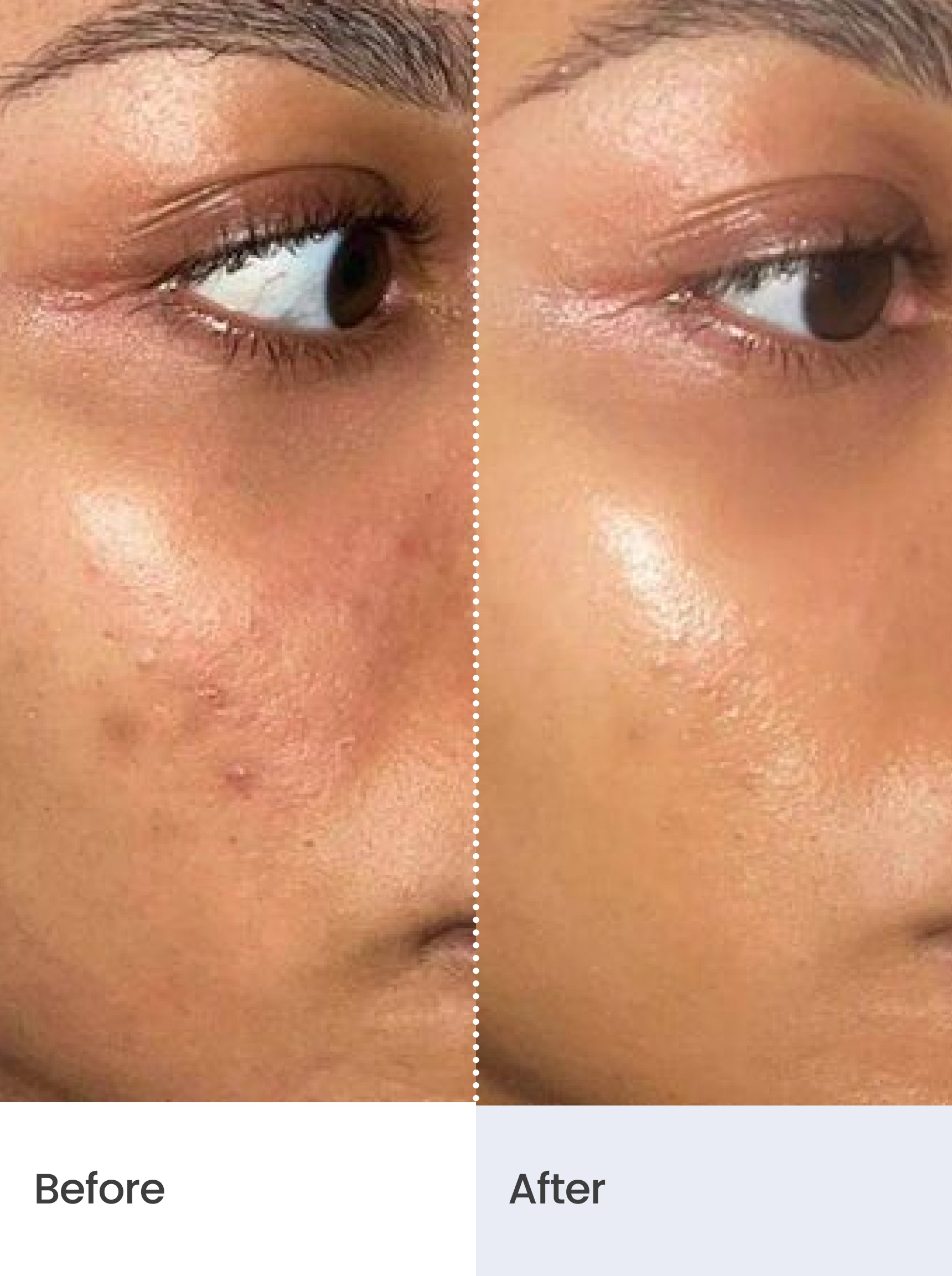 AGE RESET™ Night Serum