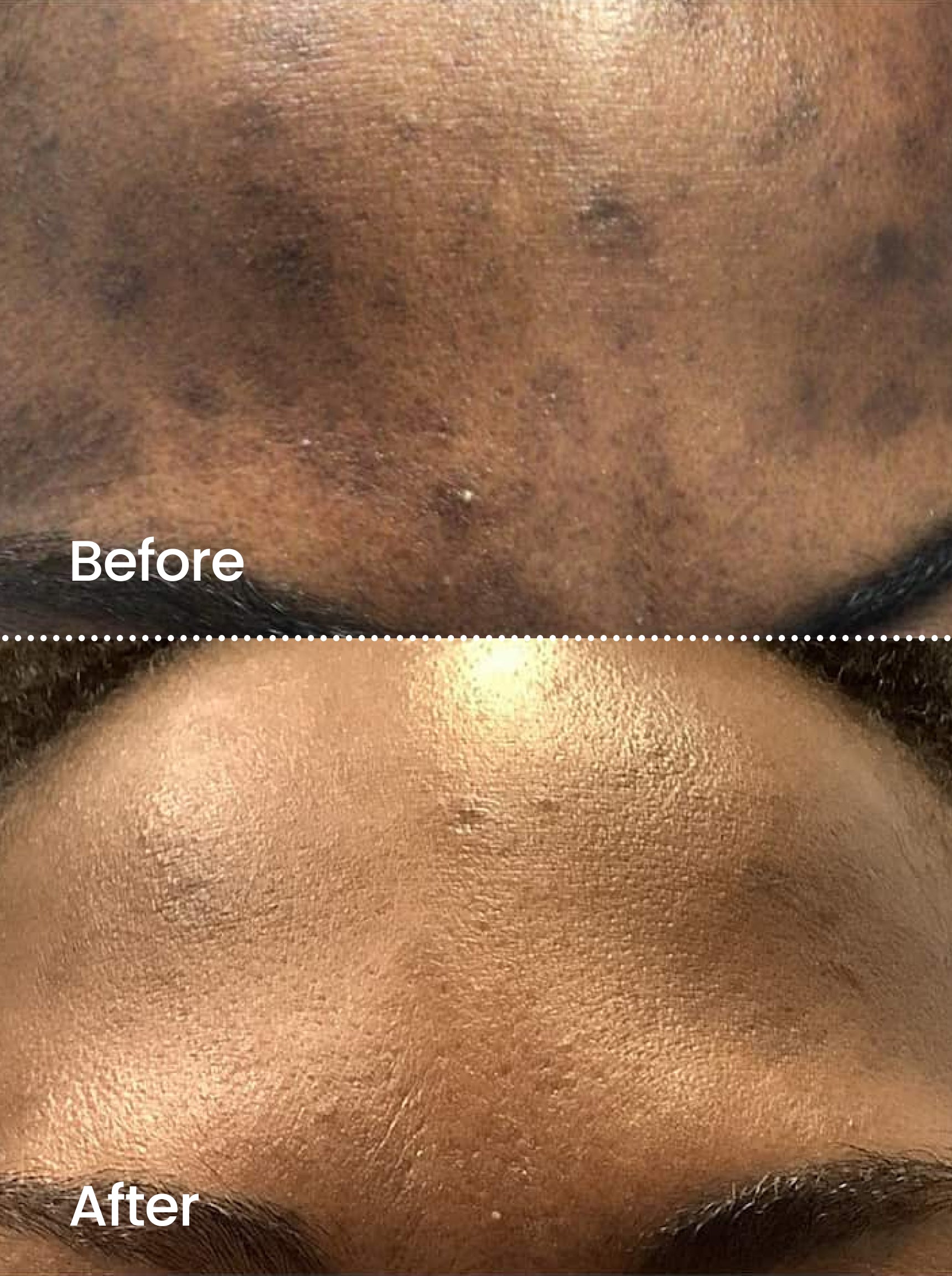 TONE CORRECT™ Dark Spot Serum