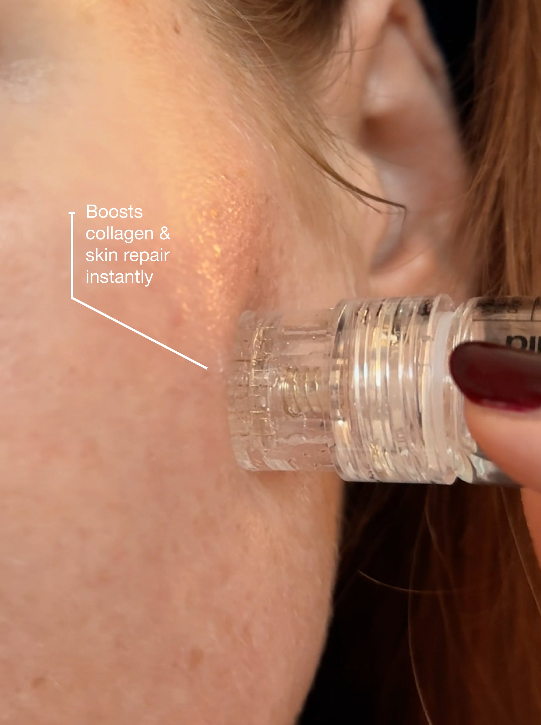 CLINICAL SKIN VOLUME FILLER SYSTEM
