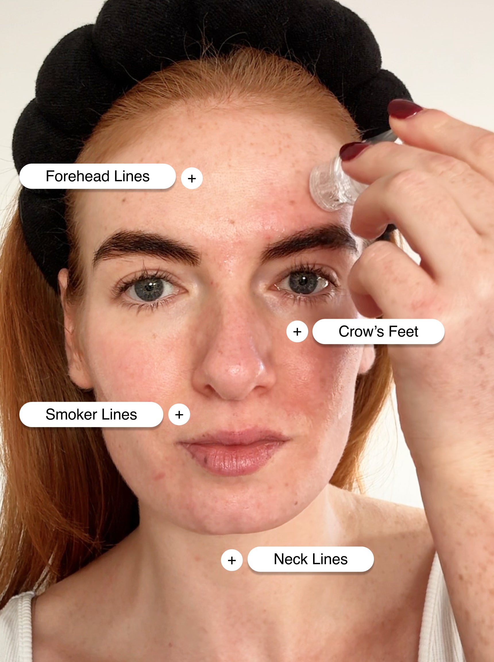 CLINICAL SKIN VOLUME FILLER SYSTEM