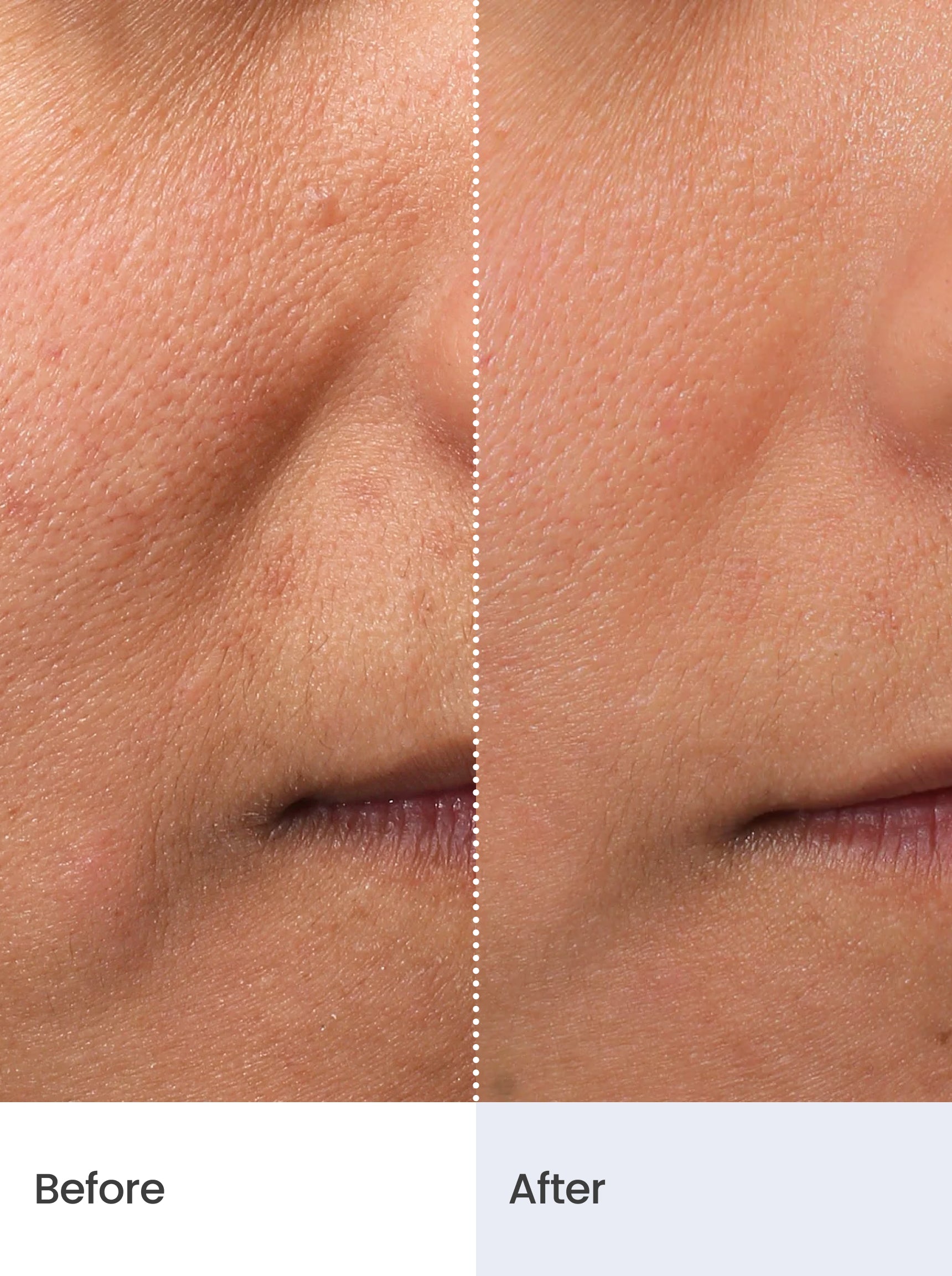 FIRMING RADIANCE™ Botox-like Peptides Serum