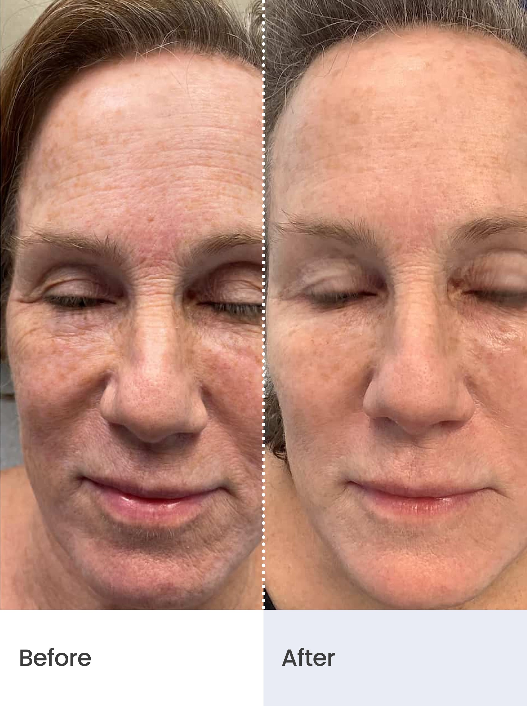 FIRMING RADIANCE™ Botox-like Peptides Serum