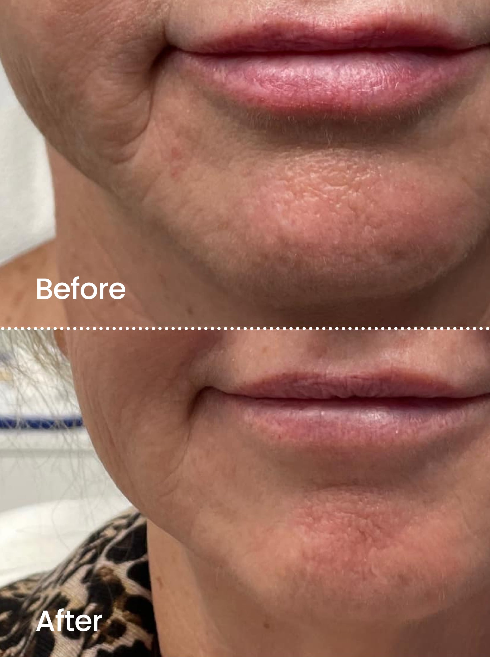 FIRMING RADIANCE™ Botox-like Peptides Serum