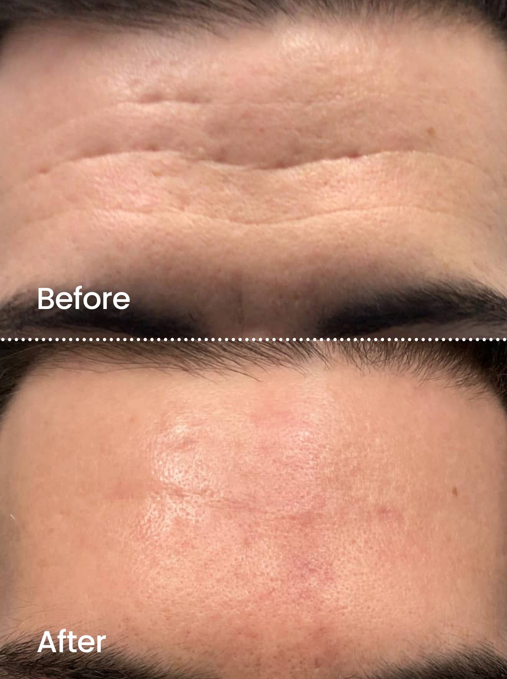 FIRMING RADIANCE™ Botox-like Peptides Serum