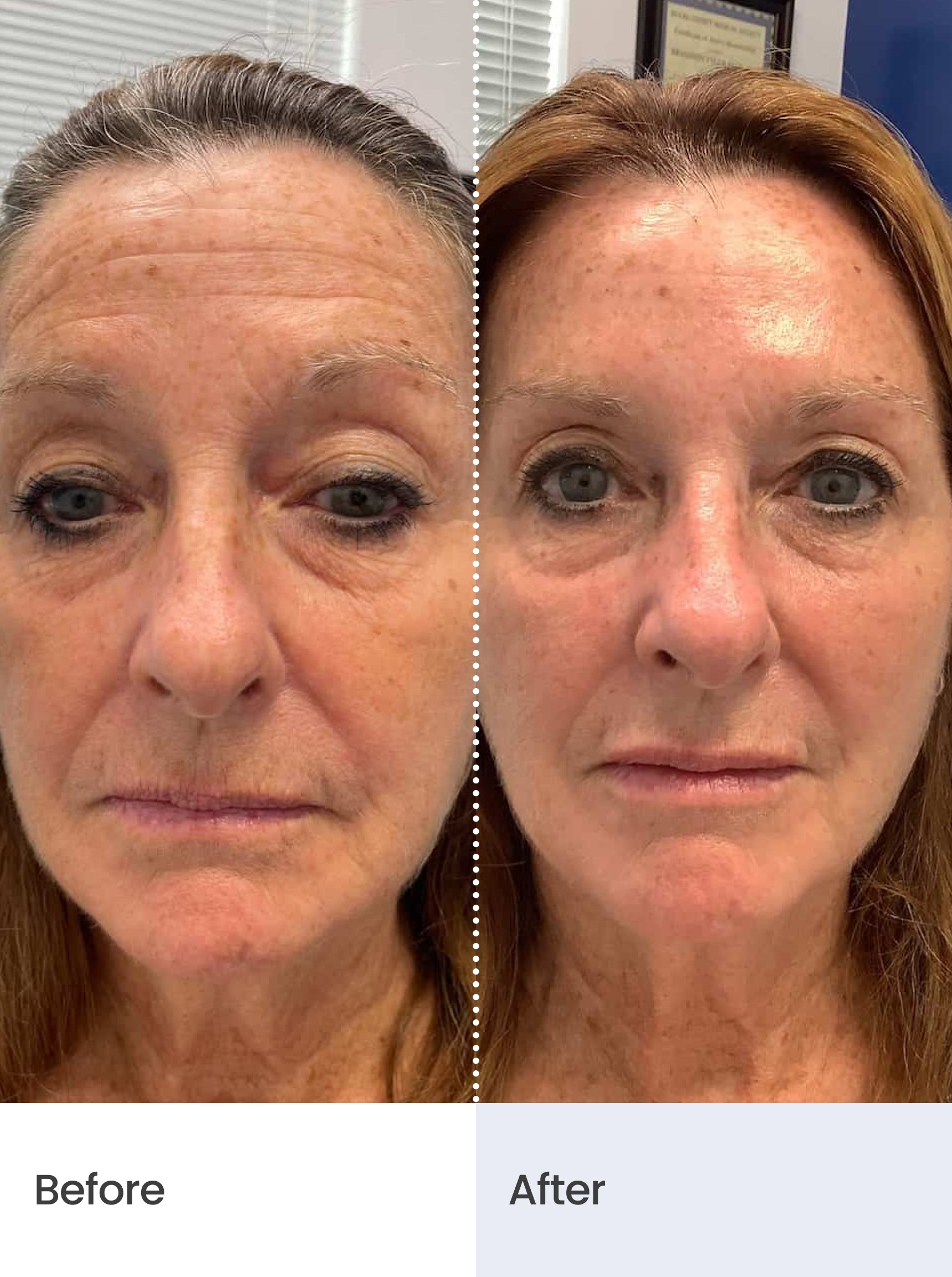 AGE RESET™ Night Serum